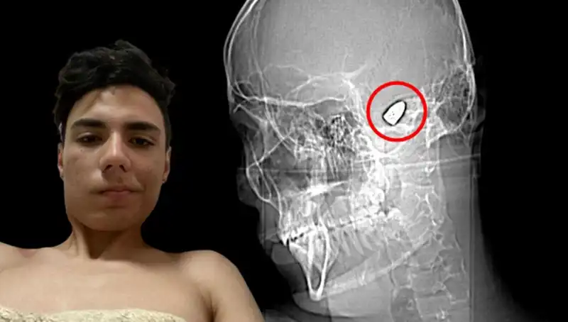 Kafasında Patlayıcı Var: Psikolojik Sorunlarla Mücadele Edenlerin Hikayesi