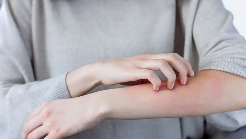 Cilt Kanseri Alarmı: Dermatologdan Kaçırılan İki Kritik Belirti