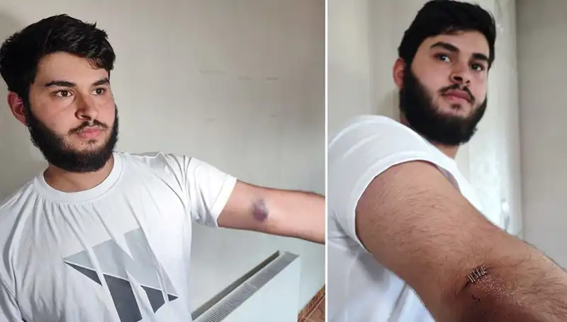Mahallede Hareketli Anlar: Conolar, Topun Peşine Kamyonetle Düştü!